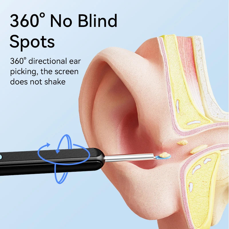 Smart visual ear cleaner with camera and led light