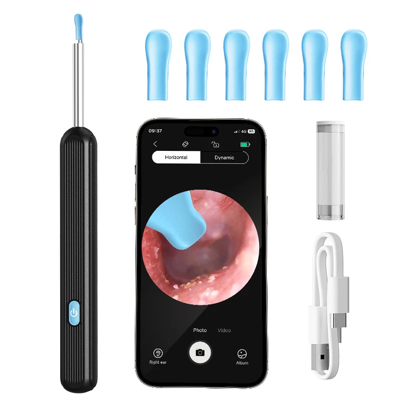 Smart visual ear cleaner with camera and led light